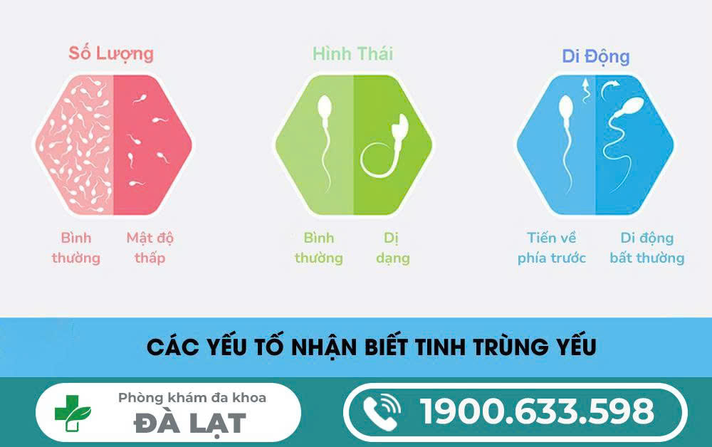 Hình ảnh minh họa